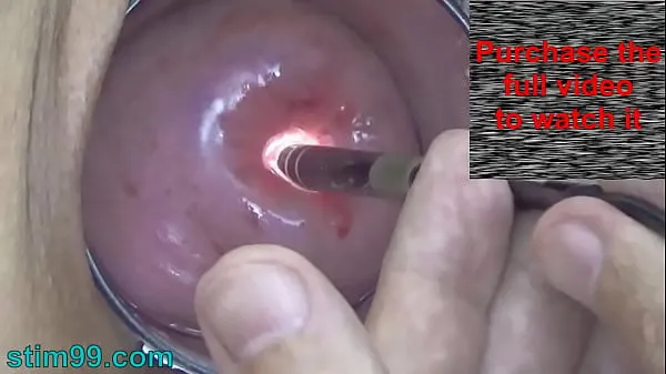 HD Endoscope Camera inside Cervix Cam into Pussy Uterus new Movies
