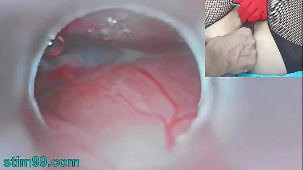 HD Uncensored Japanese Insemination with Cum into Uterus and Endoscope Camera by Cervix to watch inside womb new Movies