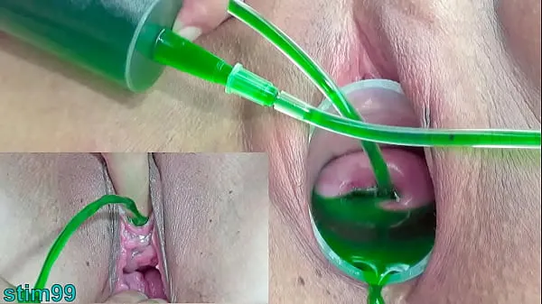 HD Cervix and Pee Hole Inflation with Injections for Japanese Lesbians Phim mới